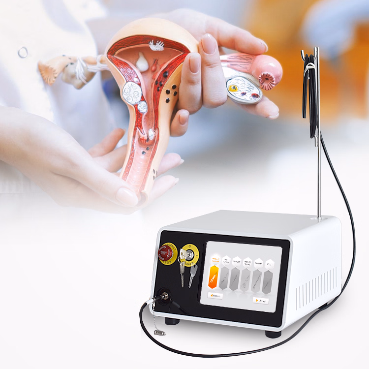 Vaginal Tightening by Lasers.avif